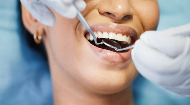 Best Dentist for Tooth Abscess  in Desert Edge, CA
