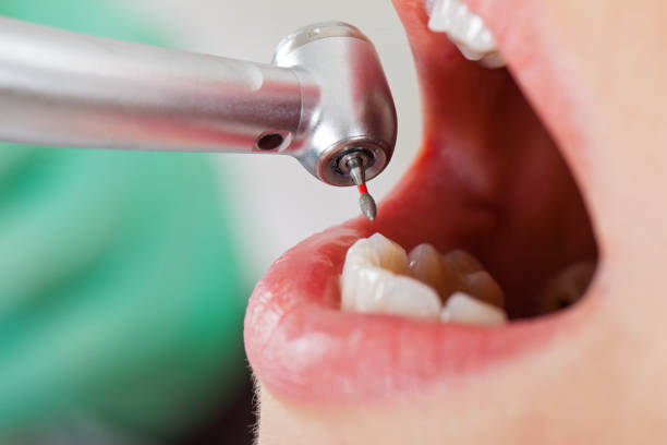 Desert Edge, CA Emergency Dentist Pros